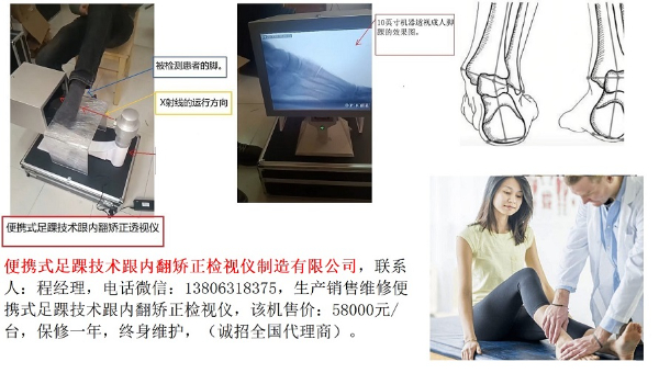 便攜式足踝技術(shù)跟內(nèi)翻矯正檢視儀
