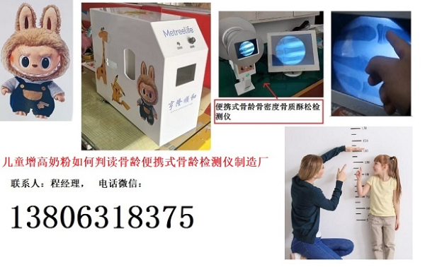 特醫(yī)食品學(xué)習(xí)兒童成長奶粉如何判讀骨齡便攜式骨齡檢測儀