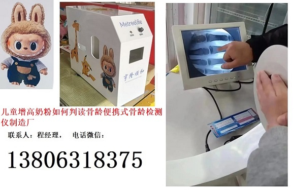 自己的娃長的更高更聰明更健康兒童成長奶粉如何判讀骨齡便攜式骨